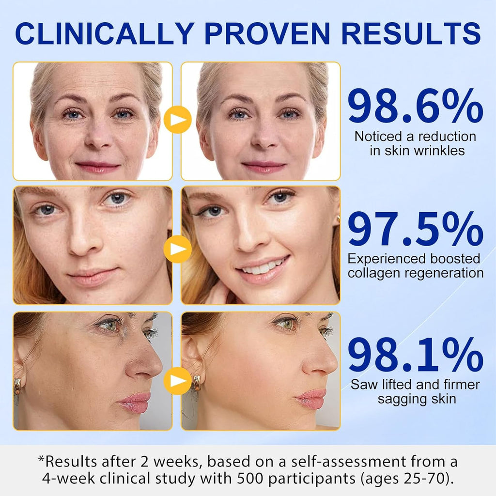 Kollagén Stick Hialuronsavval – Ráncok És Öregedés Ellen