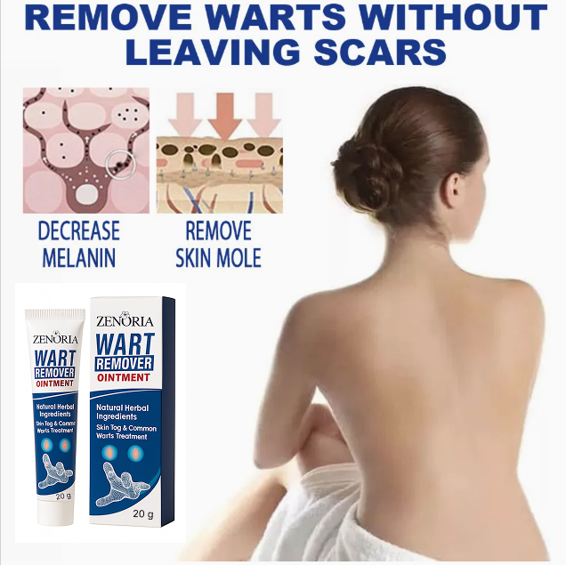 Mazilo za HITRO odstranjevanje bradavic 1+1 BREZPLAČNO