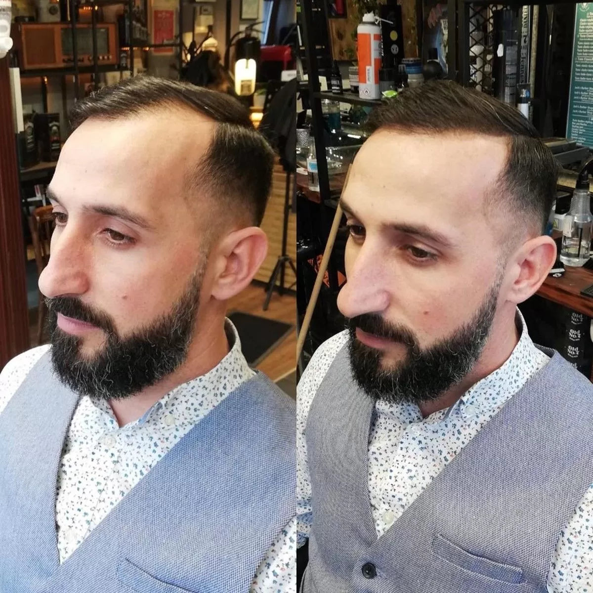 Naravni Puder Za Lase Za Spodbujanje Rasti