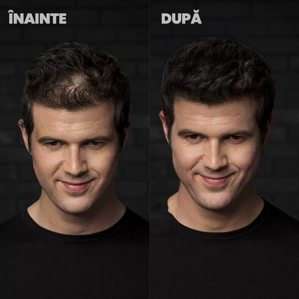 Naravni Puder Za Lase Za Spodbujanje Rasti