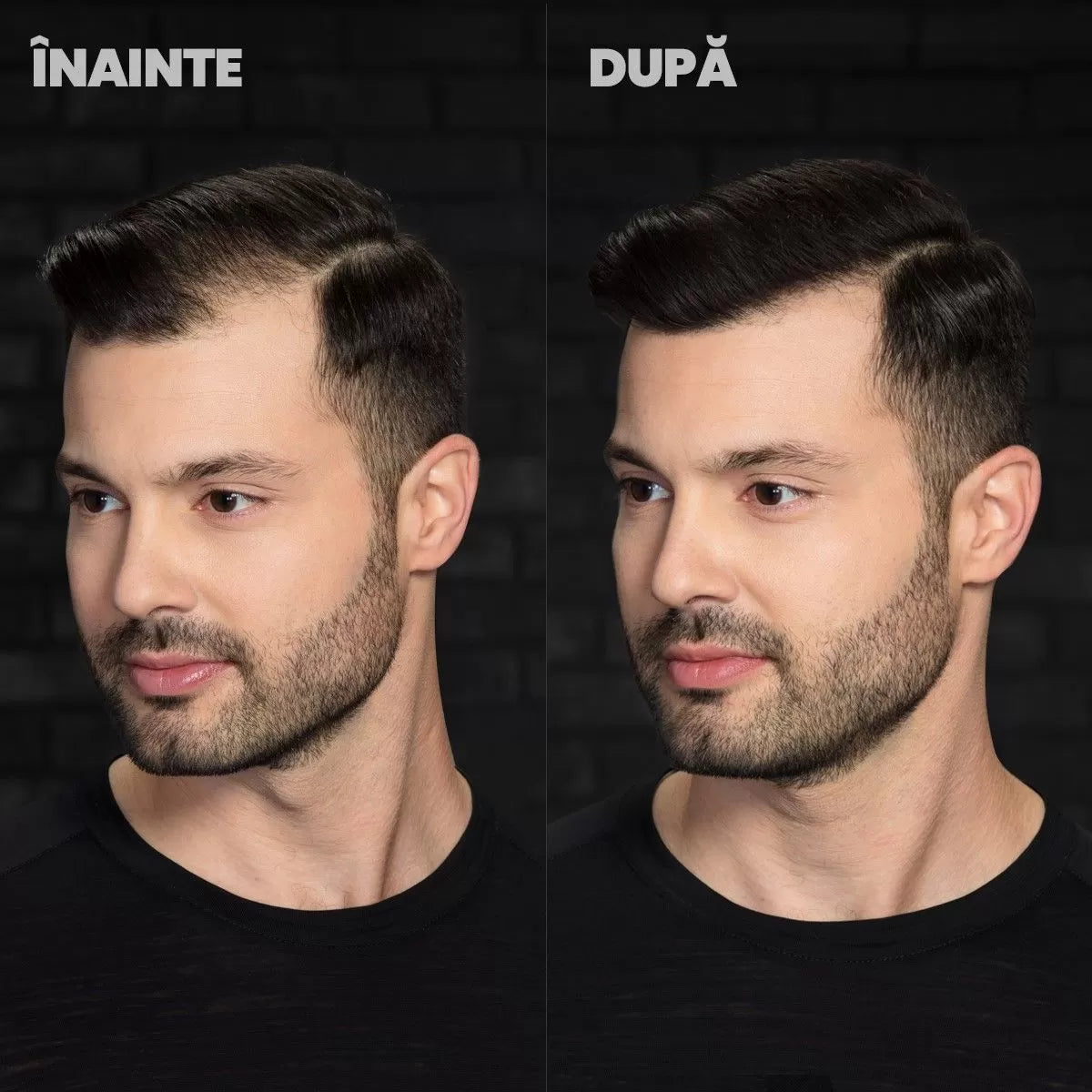 Prášok Na Vlasy Prirodzený Efekt Stimulácie Rastua