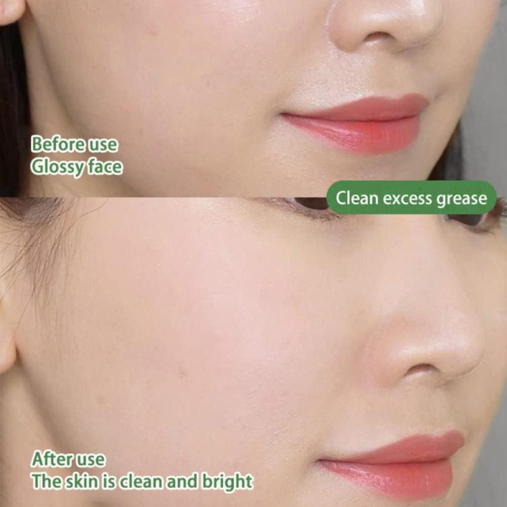 Zelena krema za aknasto kožo – formula za intenzivno čiščenje